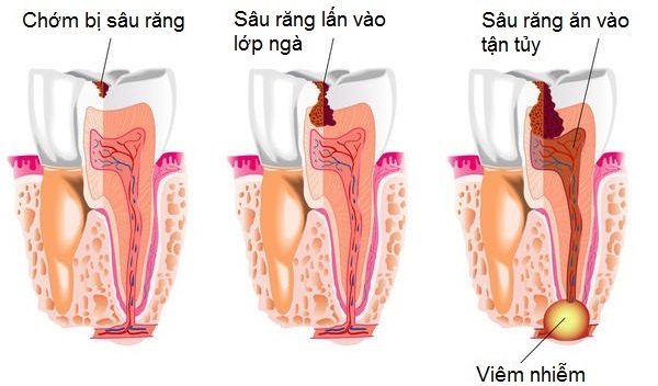 quatrinhhinhthanhsaurang