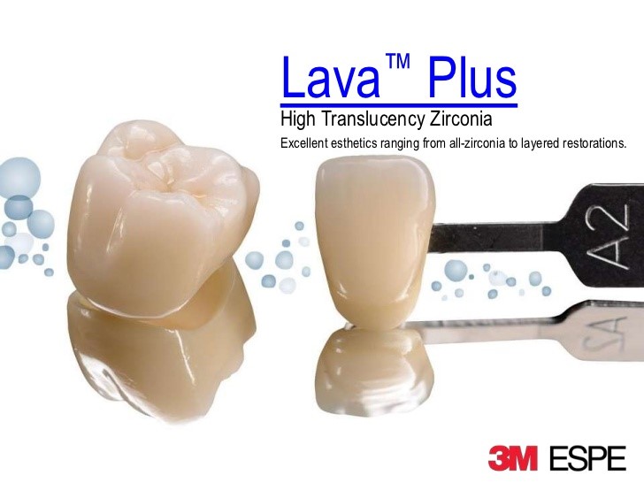 Răng sứ Lava Plus Đỉnh cao của sứ không kim loại