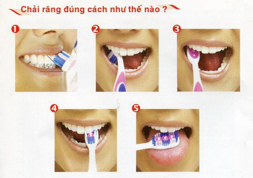 Các bước chải răng đúng cách