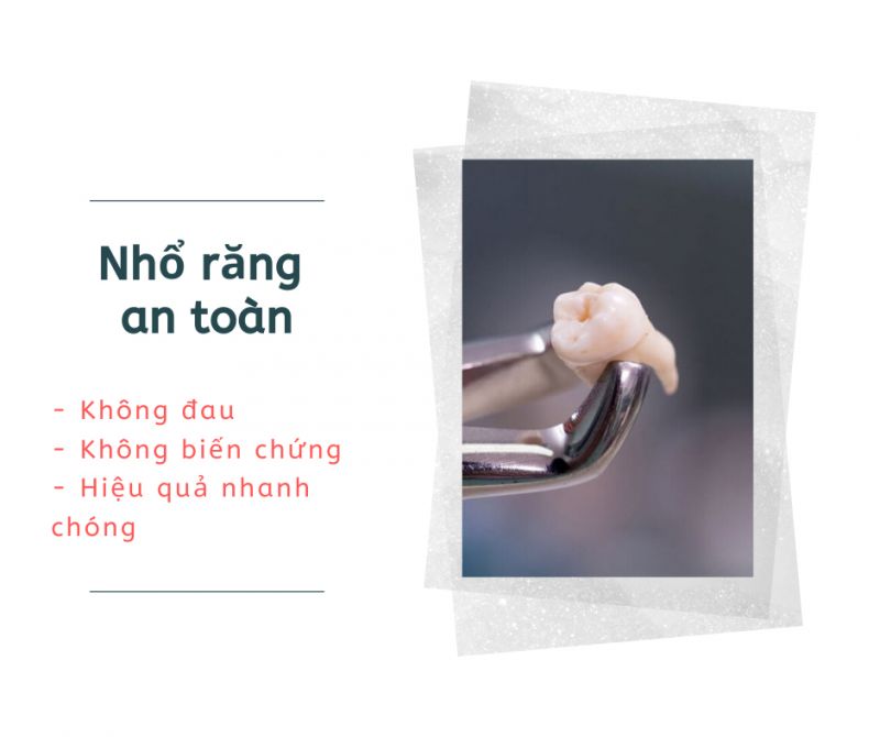 Nhổ Răng An Toàn